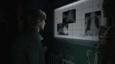 《Silent Hill 2》截屏，显示James看着一张张X光